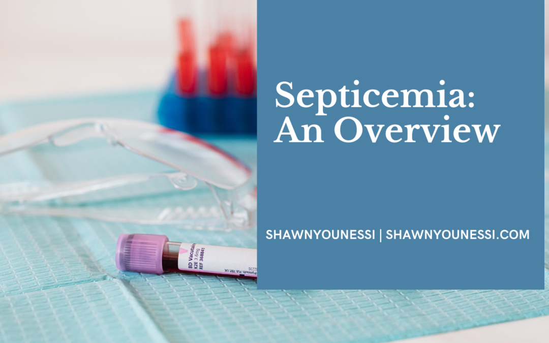 Shawn Younessi Septicemia An Overview